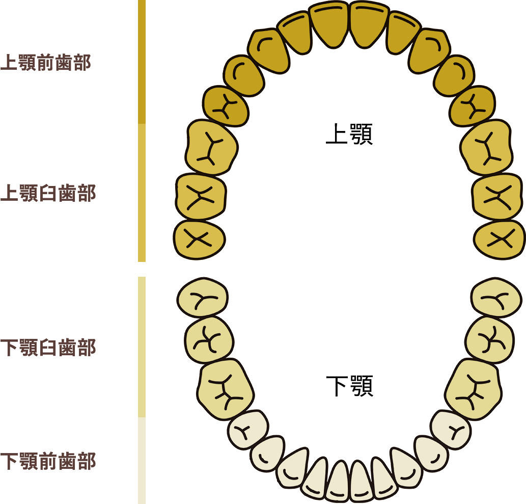 上顎前歯部　上顎臼歯部　下顎臼歯部　下顎前歯部